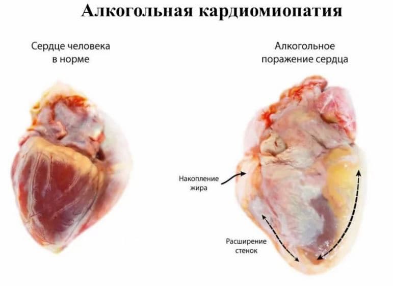 Изменения хорошо заметны